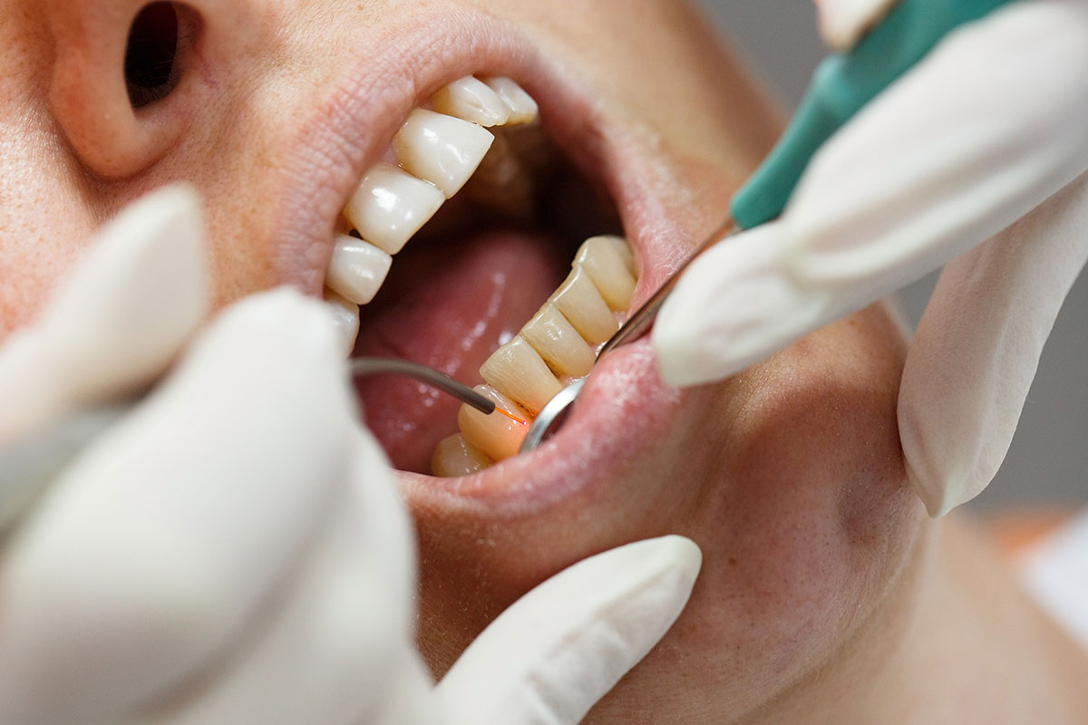 Innovative Method in Dental Health: Laser Assisted Implant Applications